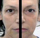 cac1-before-after